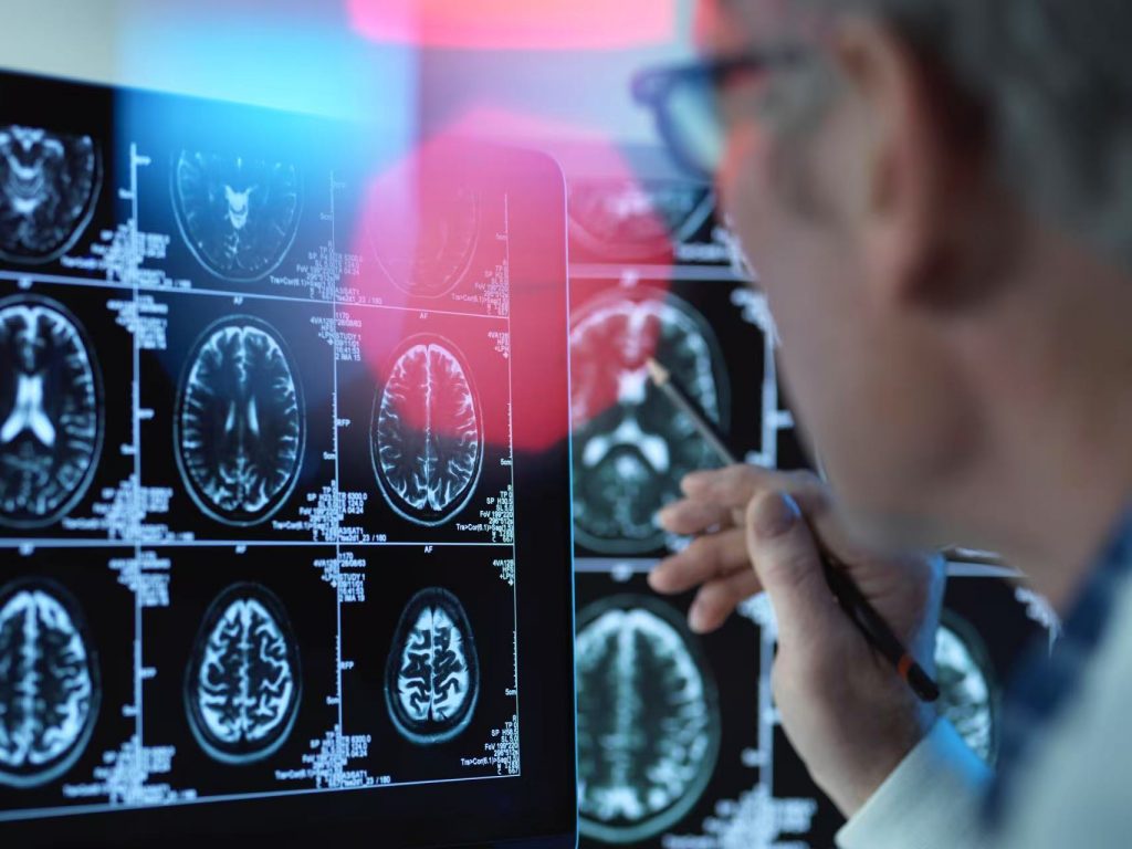 滤线栅在医学领域的重要意义